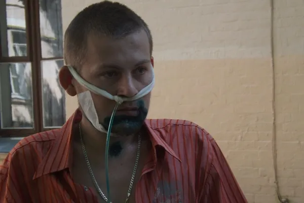 Після поранення в зоні АТО, чоловік їсть через трубку і пише прохання на папері (Фото) + (Відео) — фото 1